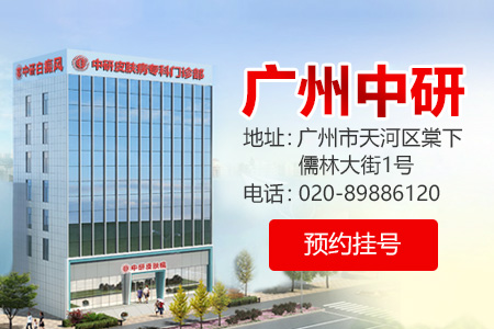 腿上白癜風怎么治療